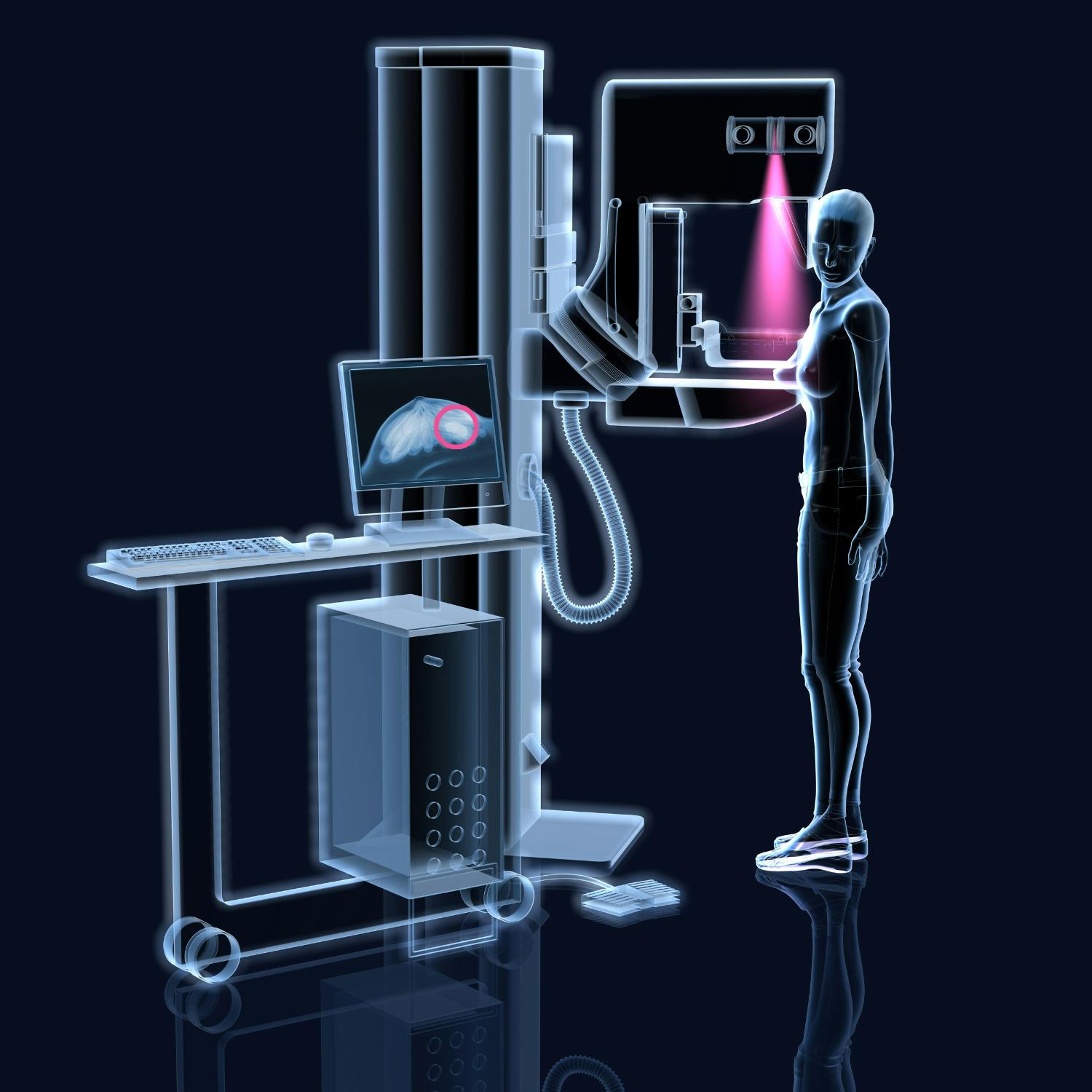 The importance of breast check and screening