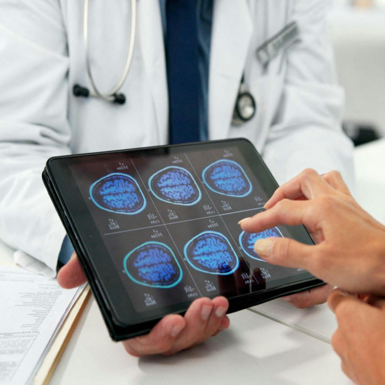 More support needed for Brain tumour patients