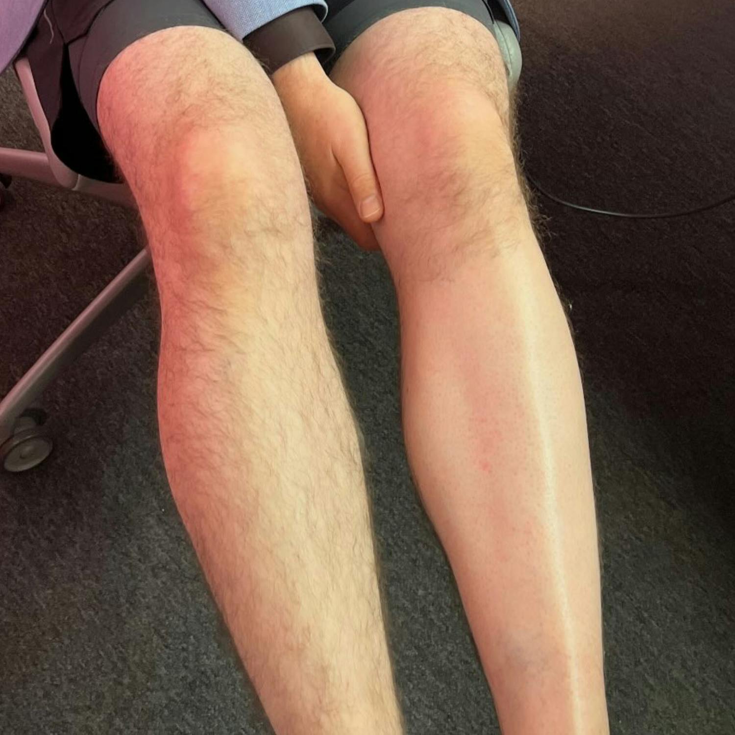 Wish Week: Shane gets waxed!