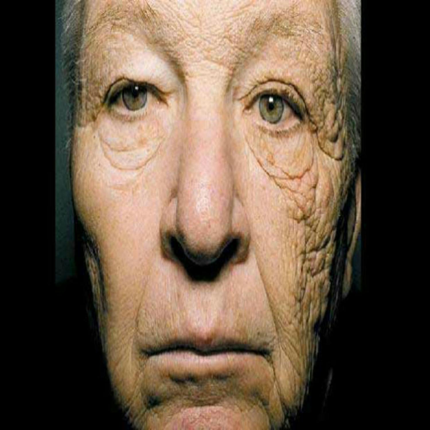 Avoiding the sun to keep your skin safe