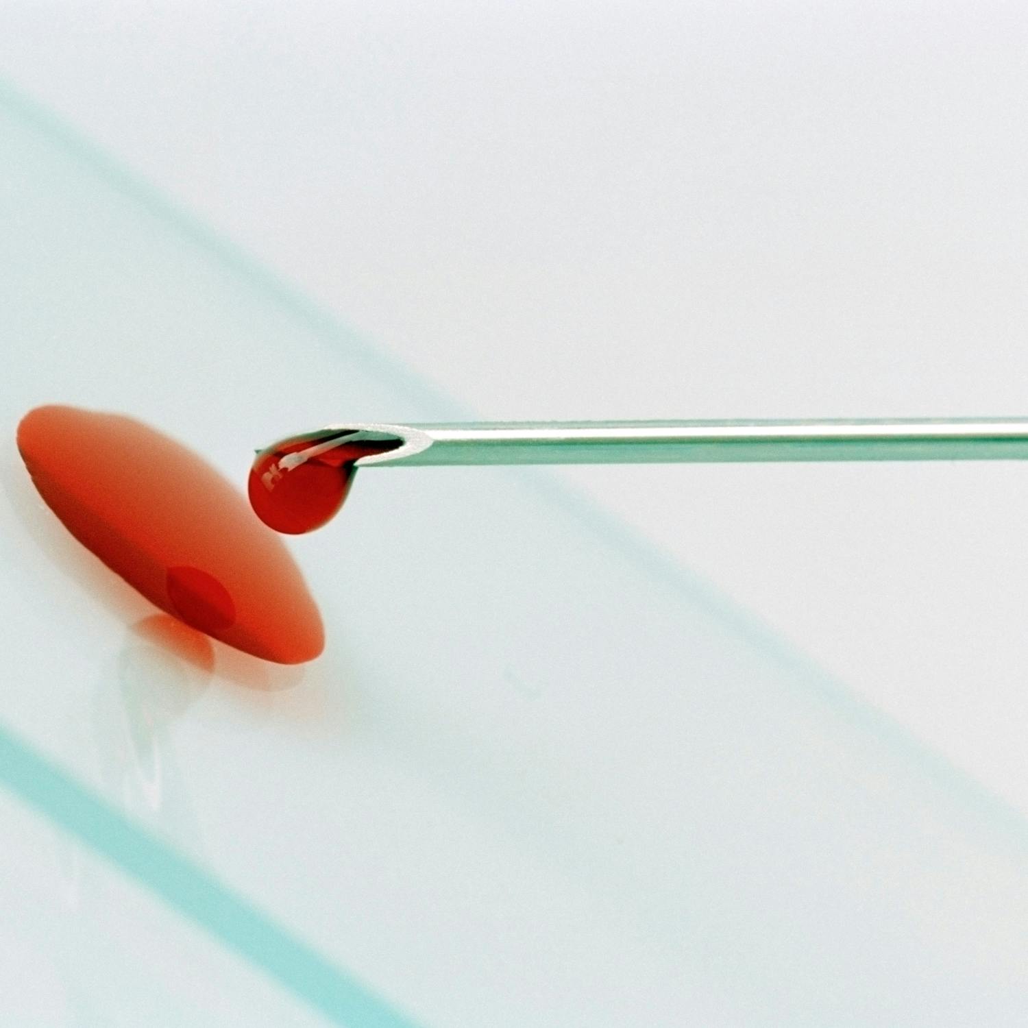 Predicting how well patients with breast cancer will respond to treatment