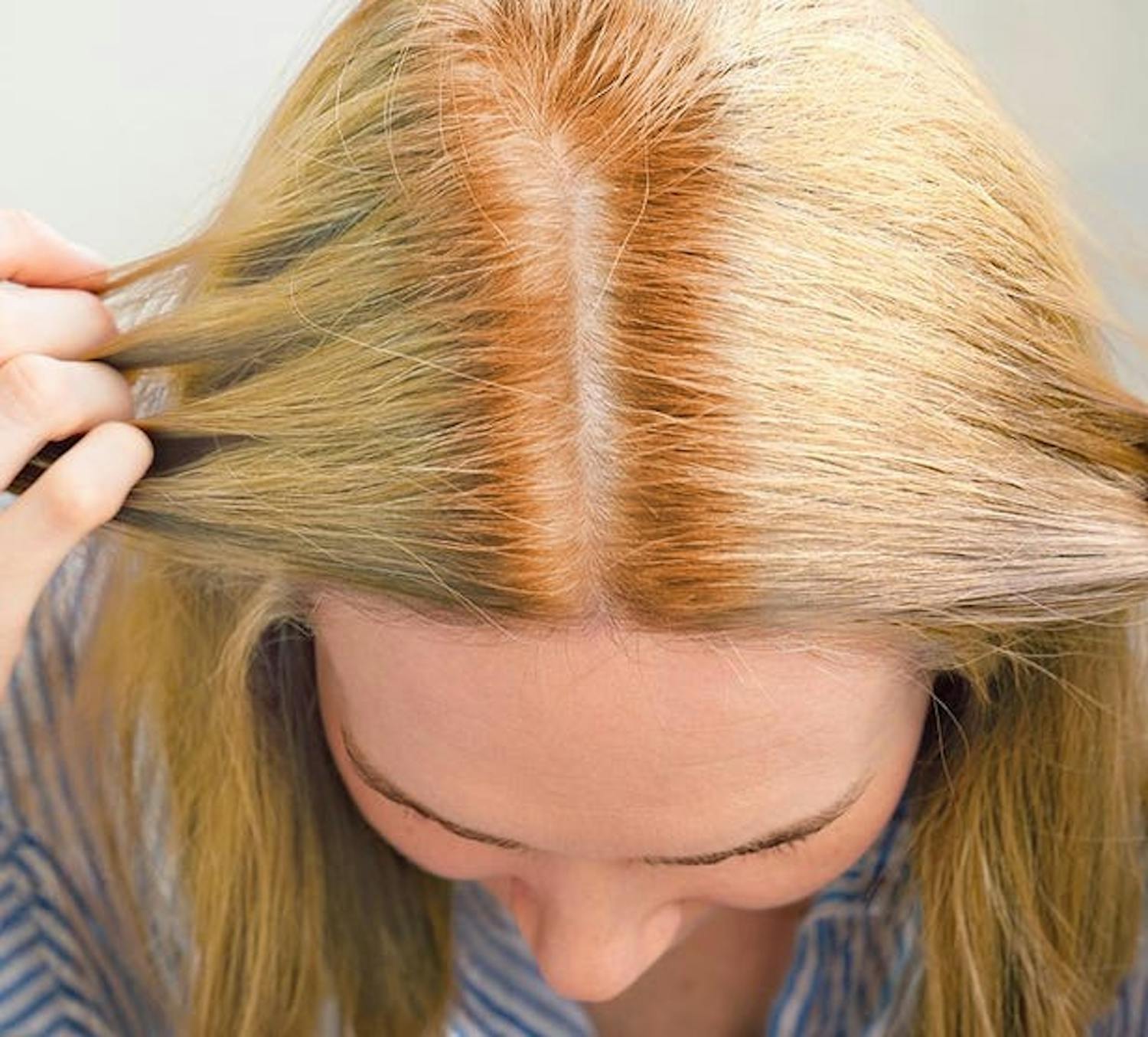 So You Think You're An Adult: I bleached my hair & its now orange, I cant face work video calls episode artwork