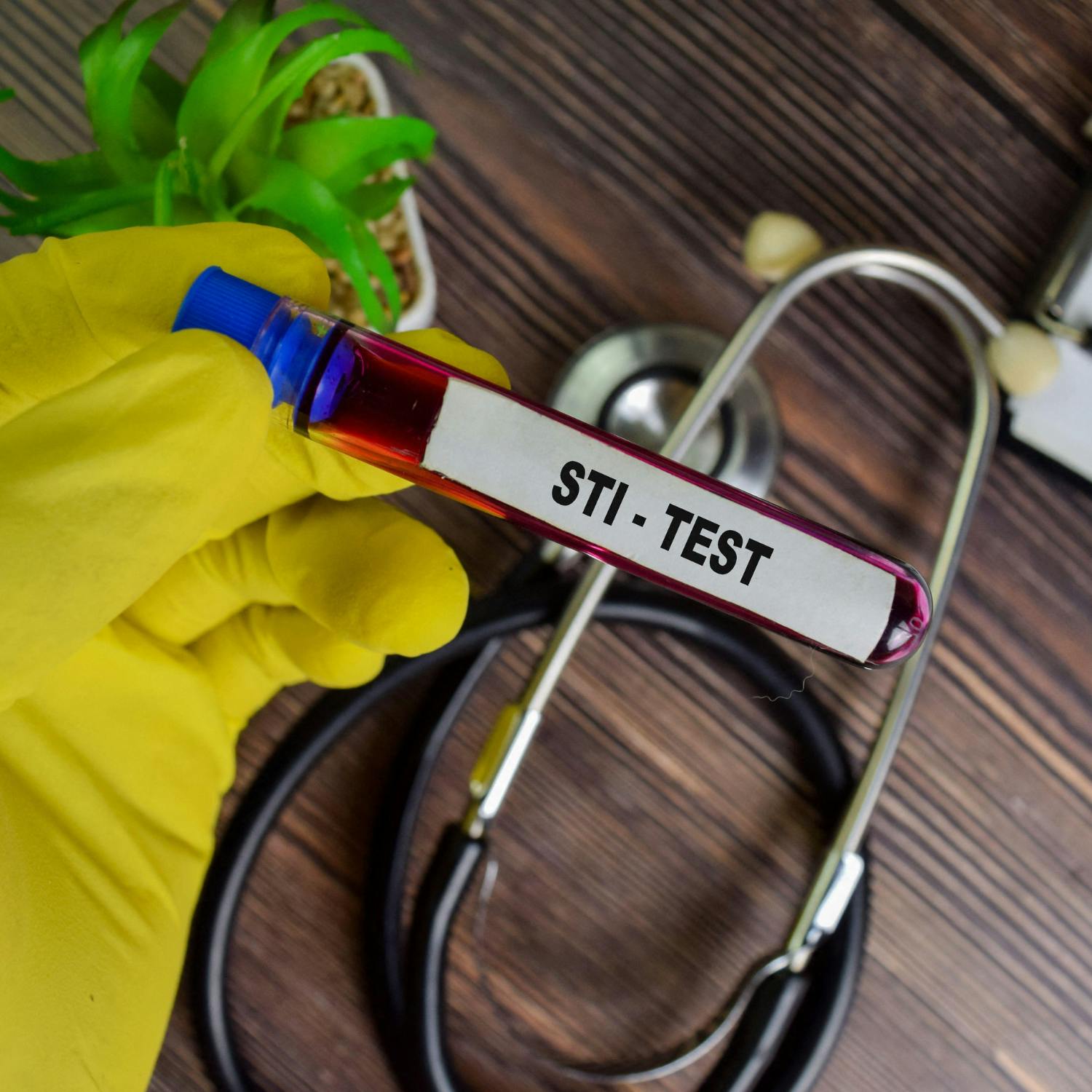 The number of cases of STI's in Ireland increasing