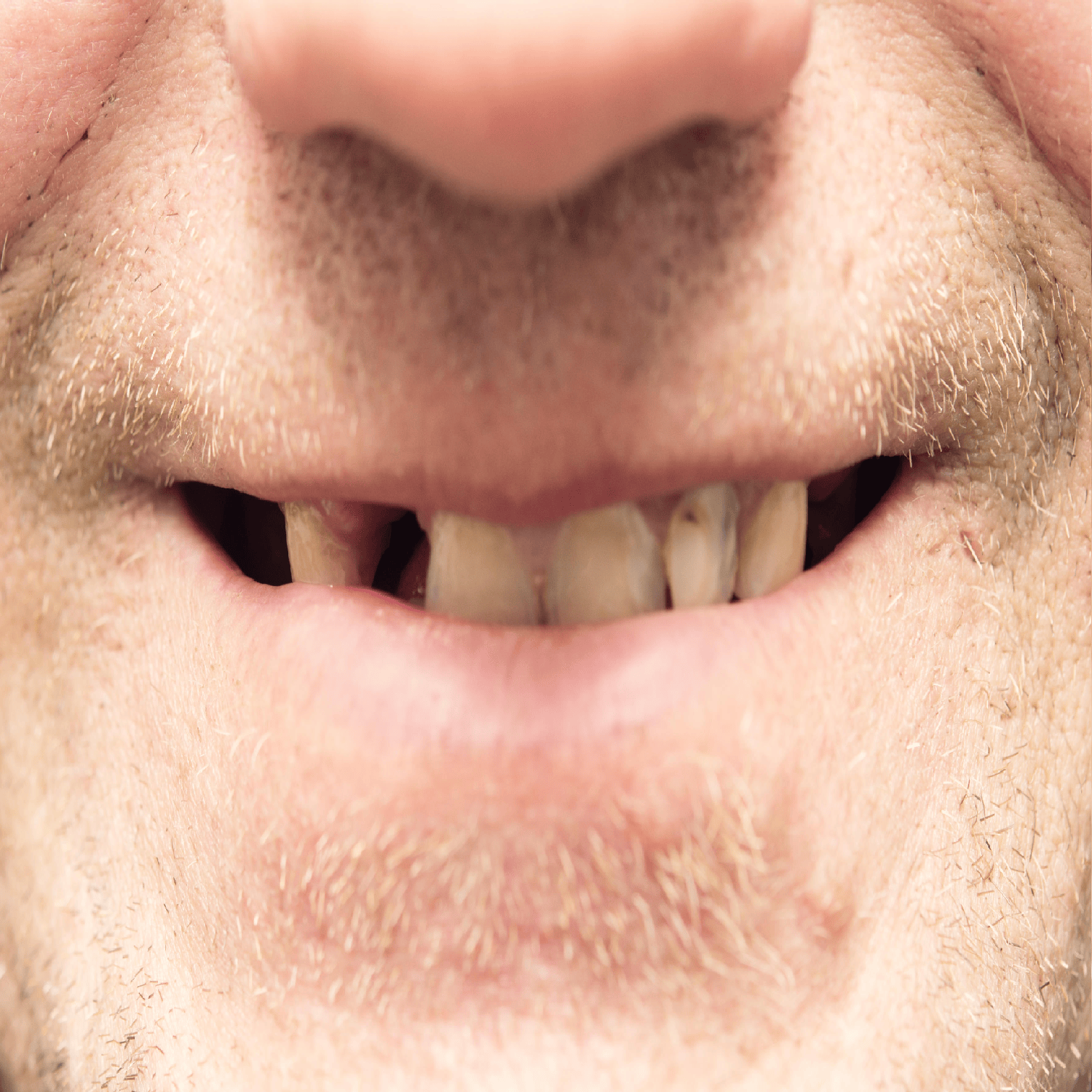 So You Think You're an Adult: I hate my fiancés teeth! episode artwork