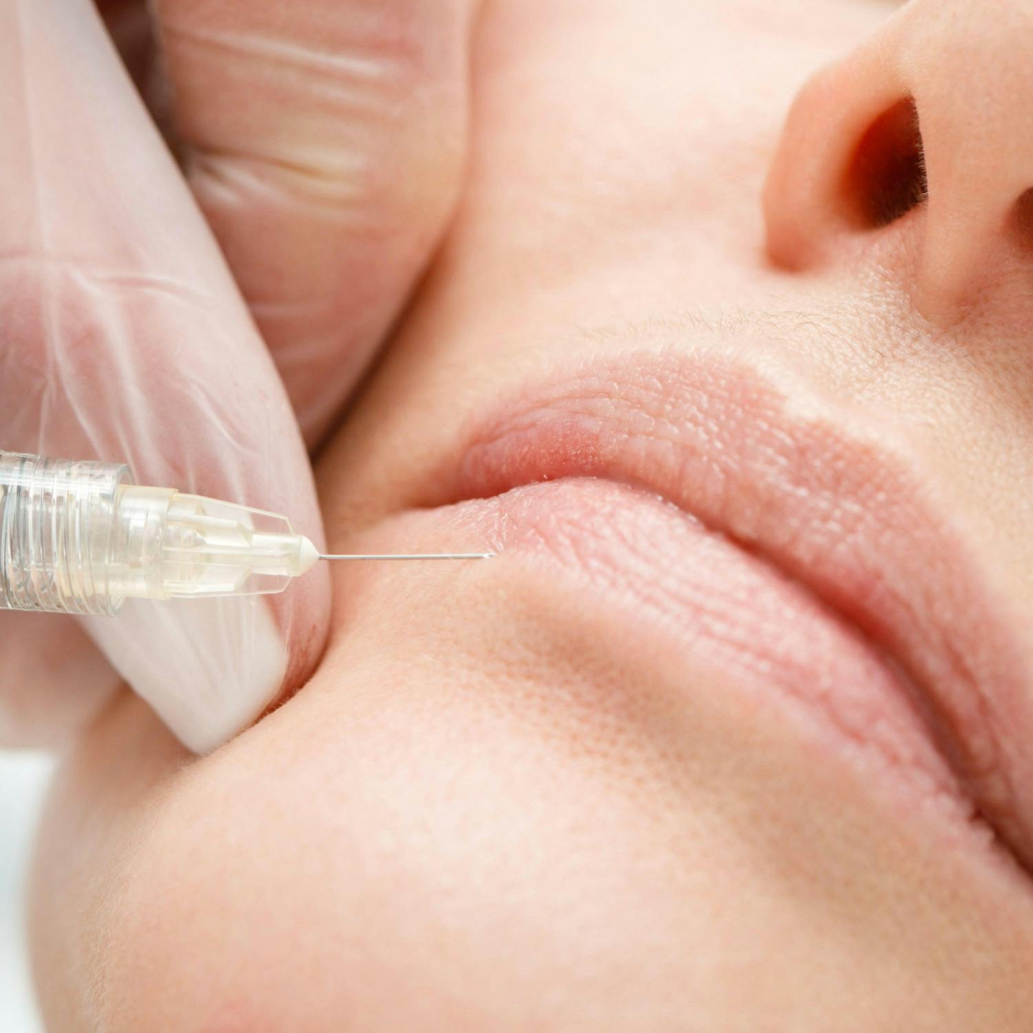 Are too many young people getting botox?
