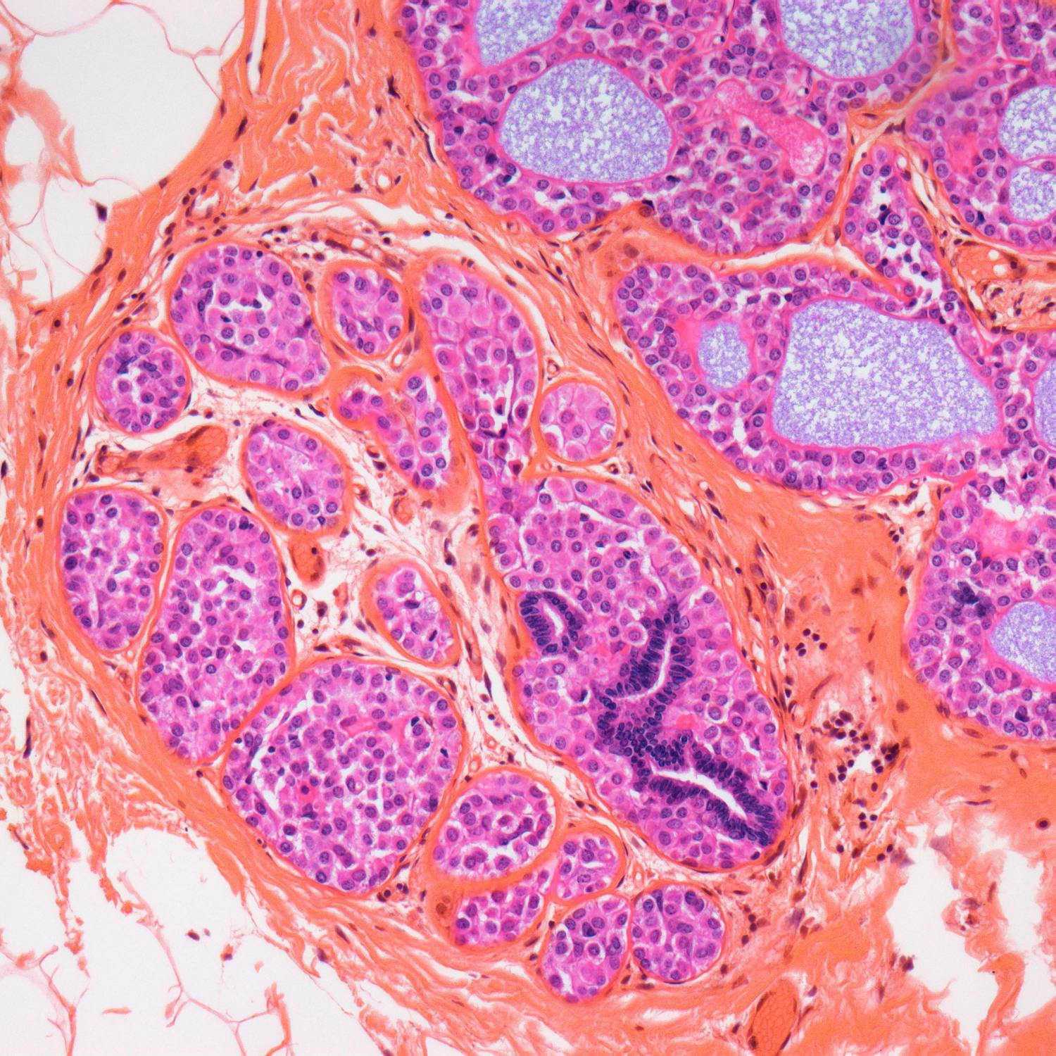 Luke O’Neill on the latest developments in cancer treatment