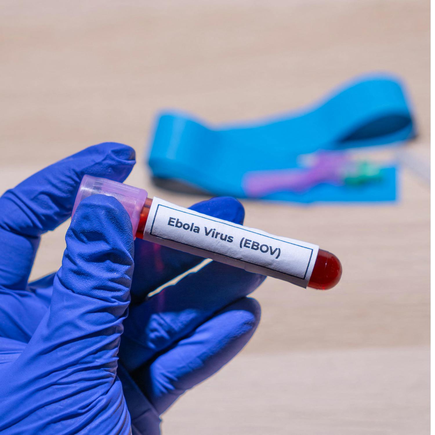 The Ebola outbreak in Uganda and the Congo