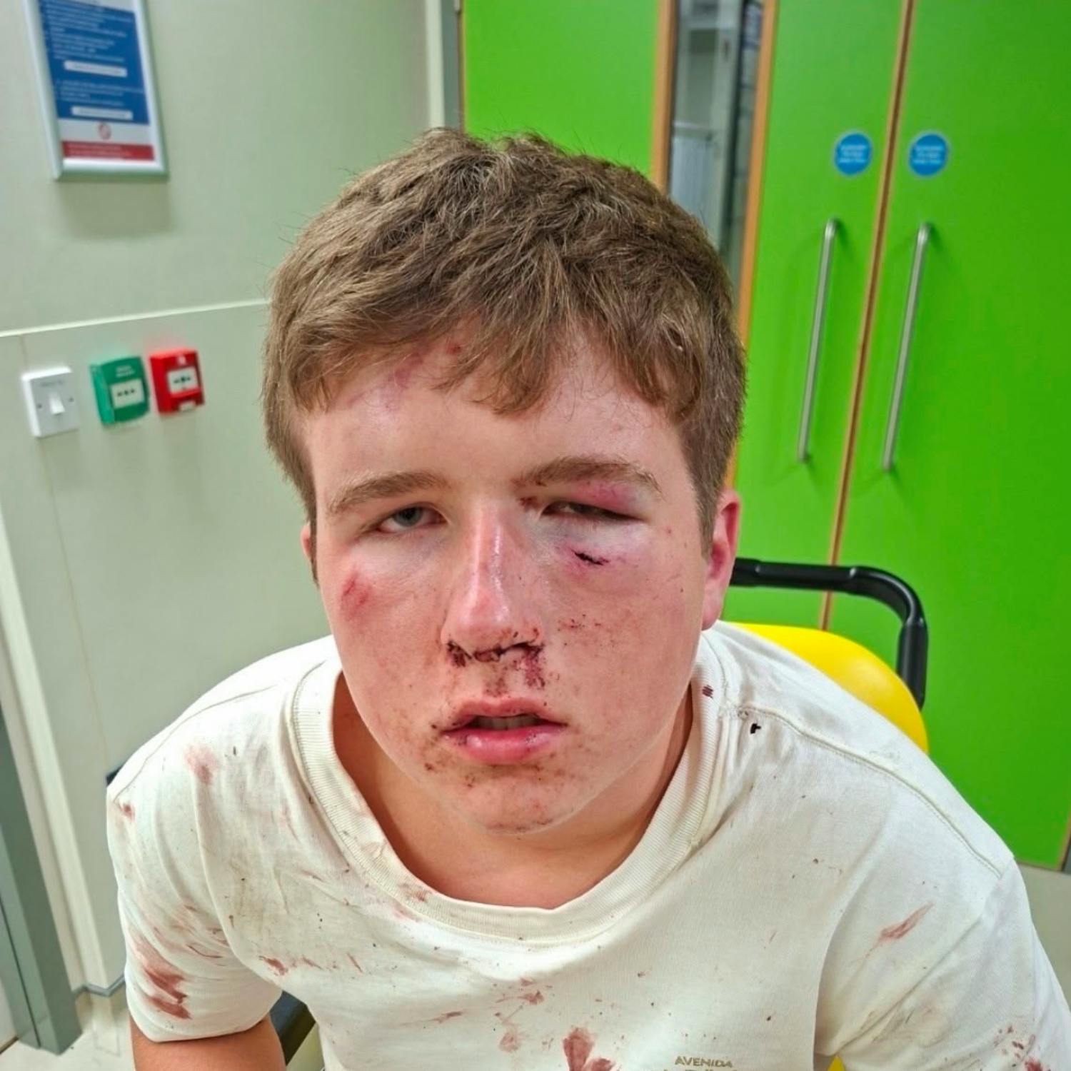 Mother issues plea after teenage son was assaulted