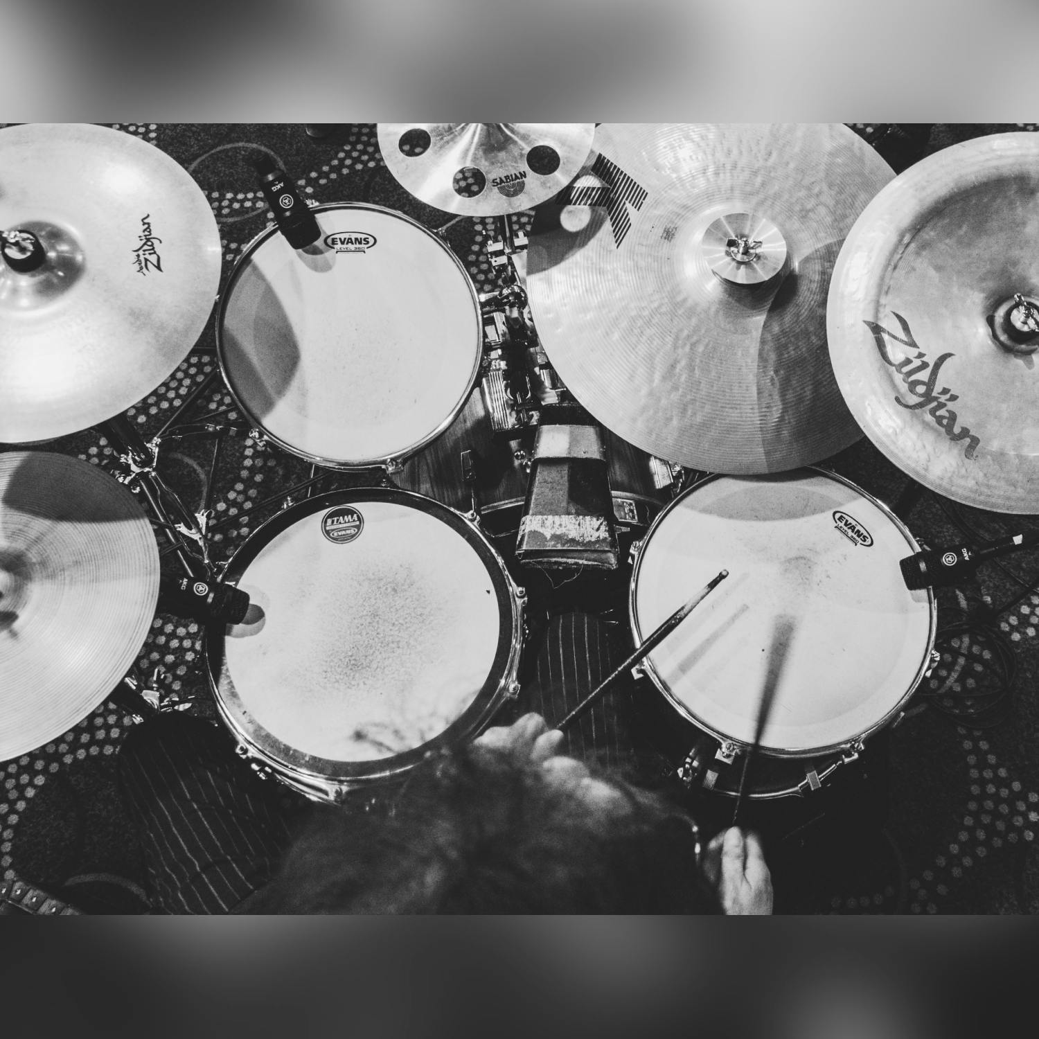 How a drummer made his own prosthesis to keep playing How a drummer made his own prosthesis to keep playing