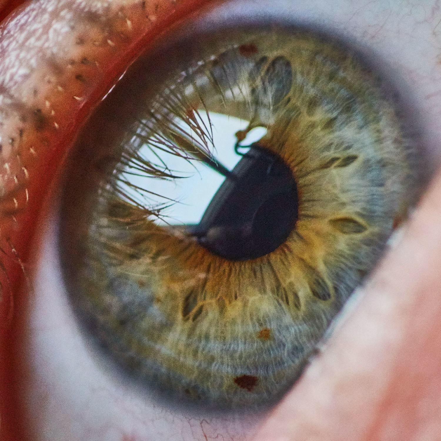 Ask the Expert: Arthur Cummings