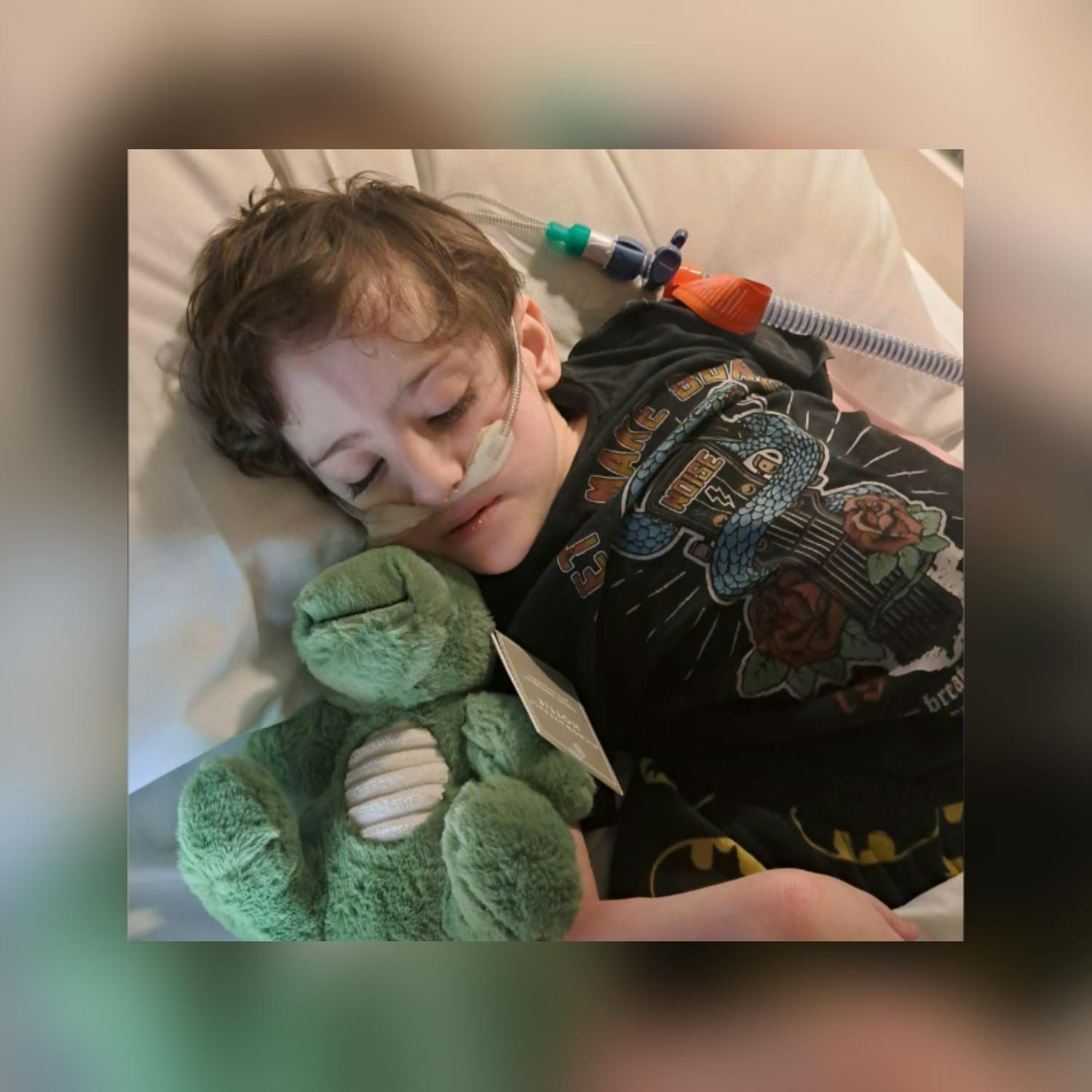 Boy with life-threatening scoliosis finally gets surgery date