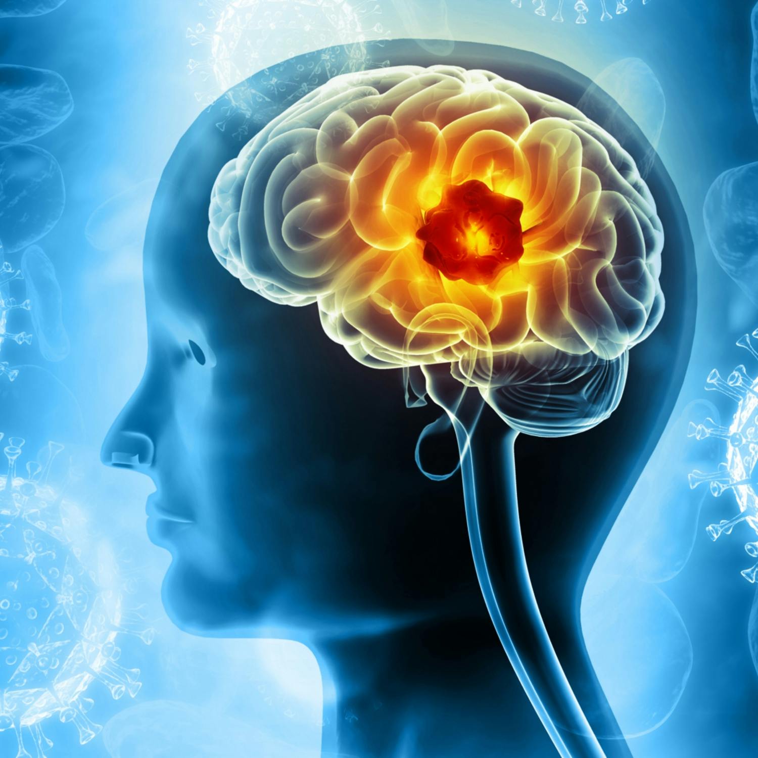 It's Brain Tumour Awareness week