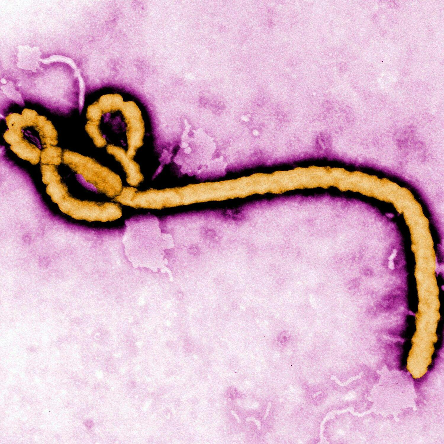 Ebola outbreak a global health emergency: What do we need to know?