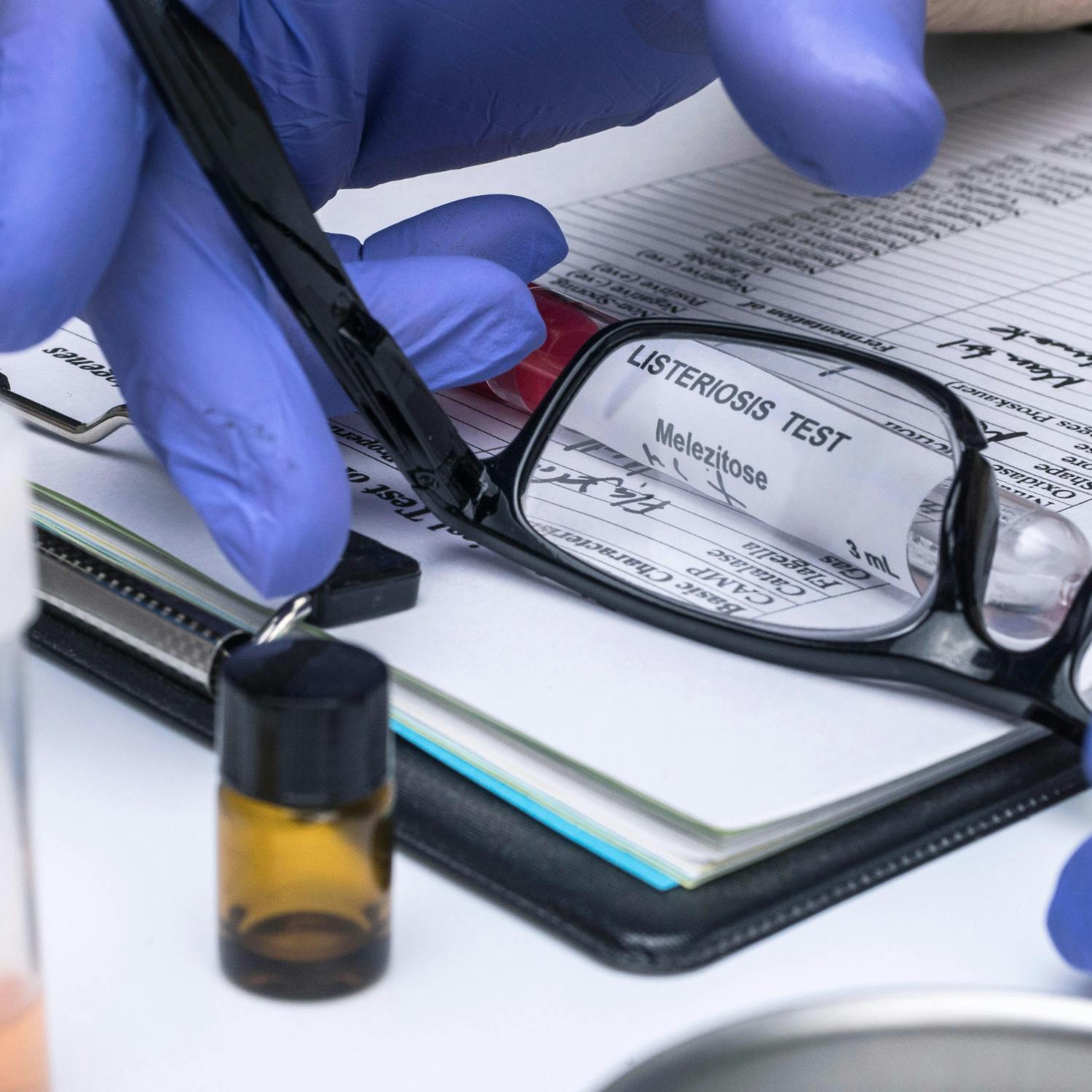 How concerned should the public be about listeria?