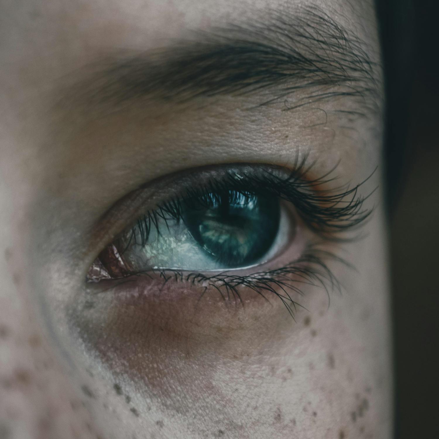 What life is like with a misaligned eye What life is like with a misaligned eye