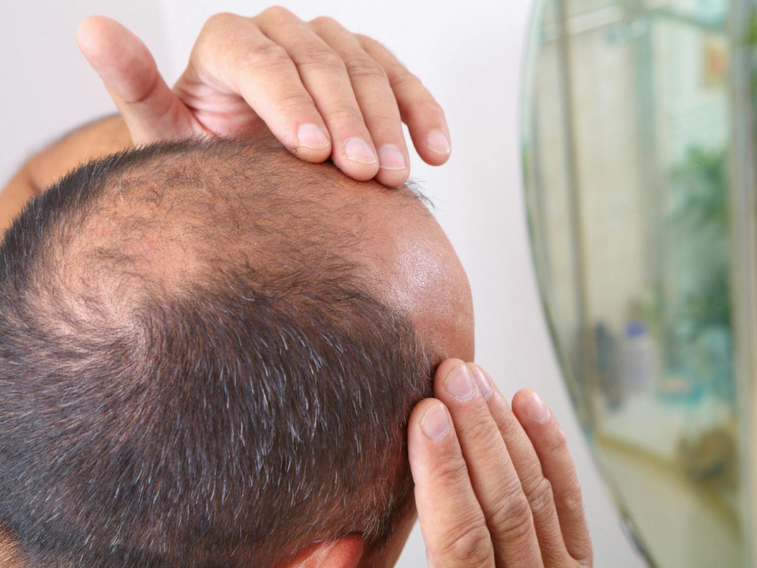 So You Think You're An Adult: My Partner is going bald, it looks awful episode artwork
