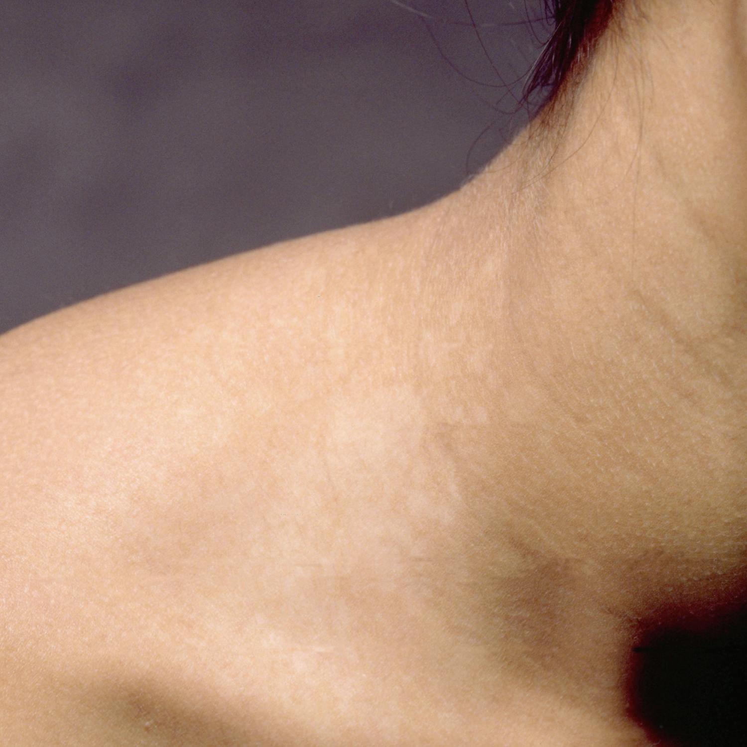 Ask the Expert: Dermatology