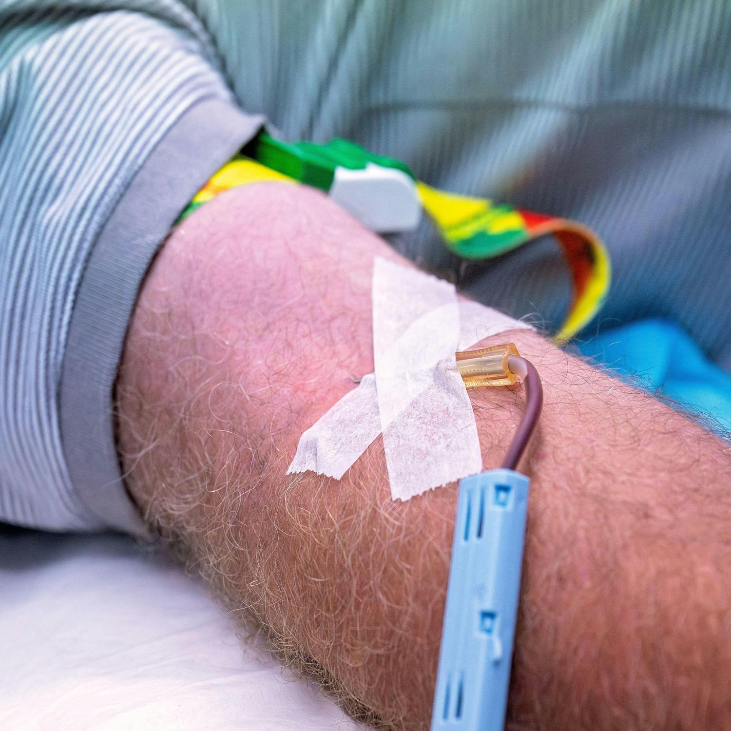 New study shows the Irish are among the most likely to develop Haemochromatosis. But why ?