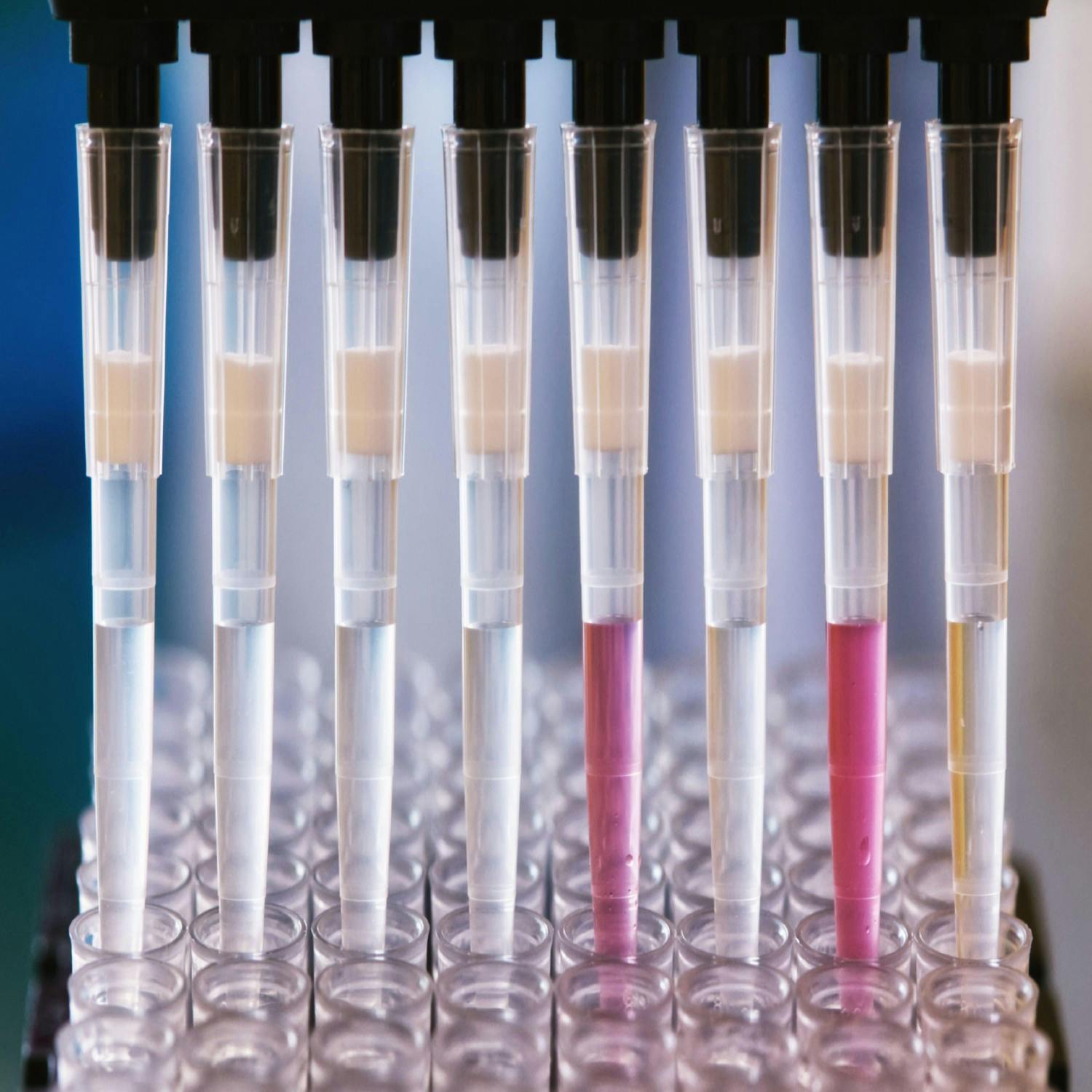 Biobanks - What they are and why they are key to disease research?