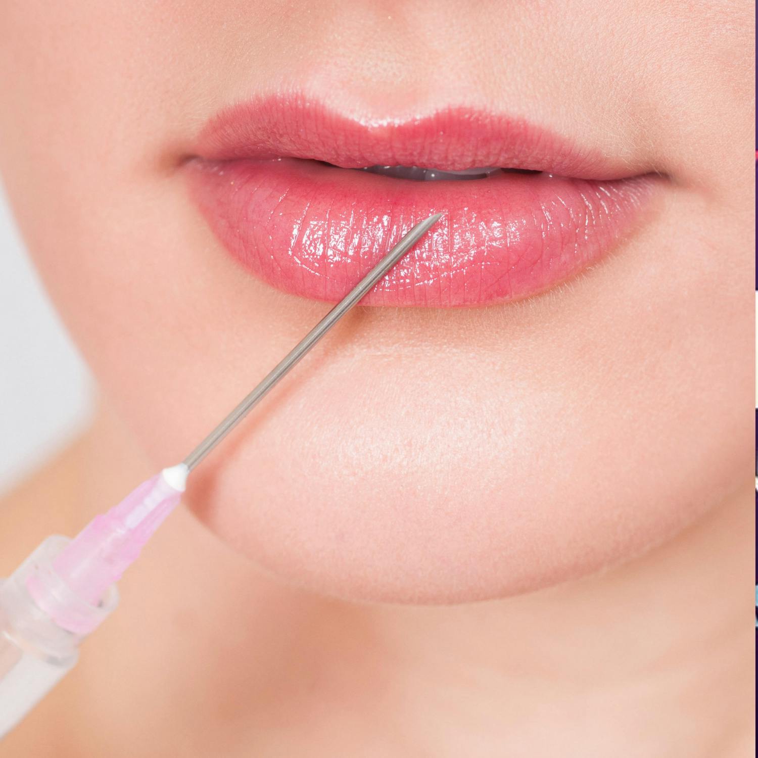The dangers of unlicensed botox procedures The dangers of unlicensed botox procedures