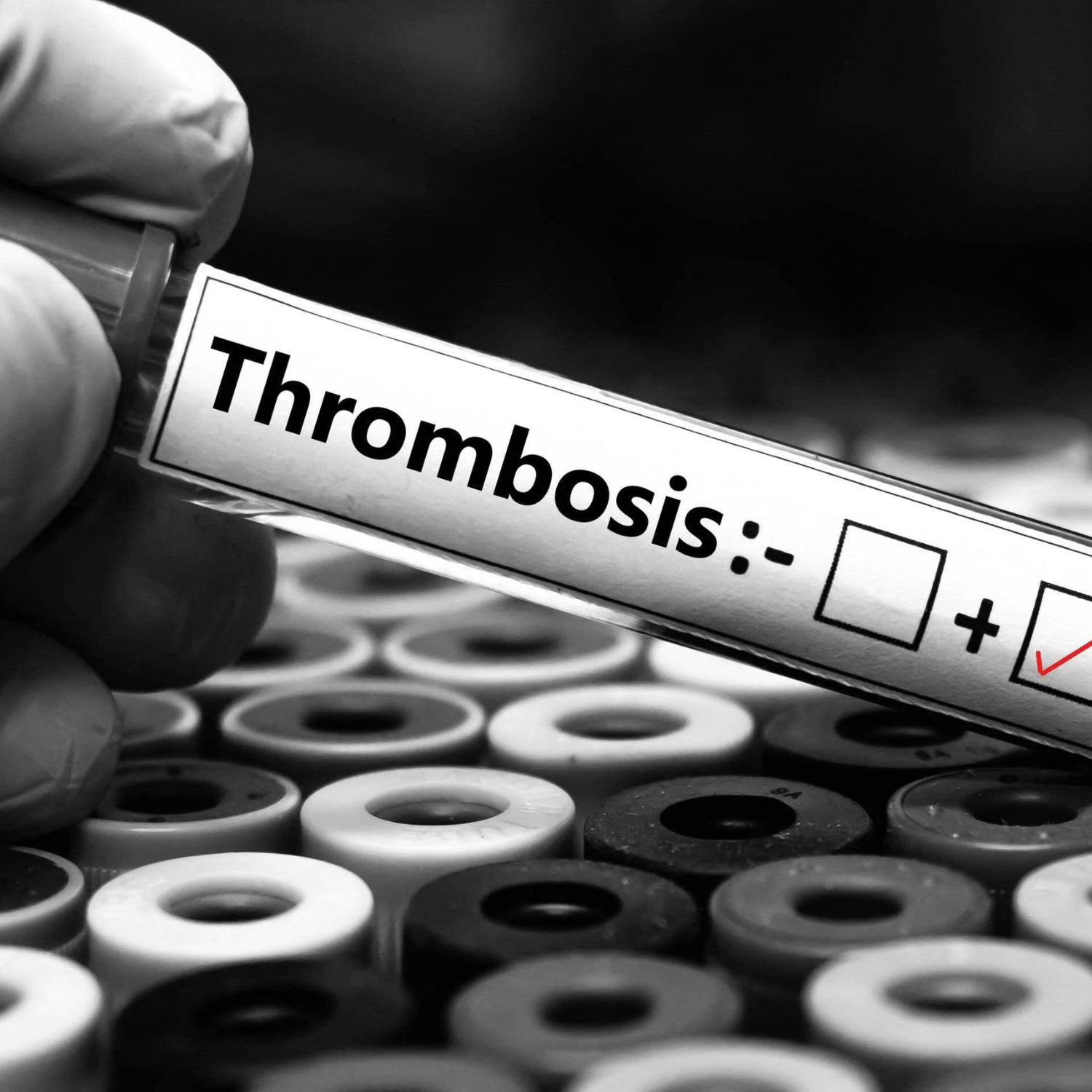 What exactly is thrombosis?