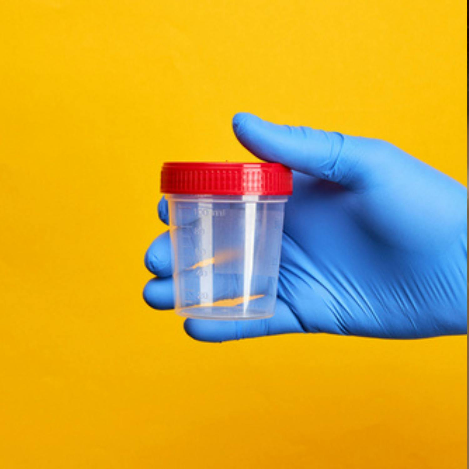 What should bosses do if one of their staff is arrested for drug taking