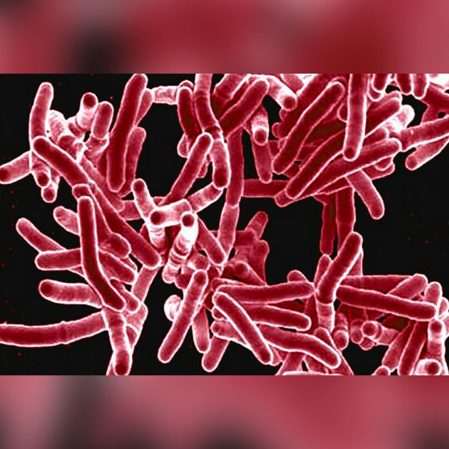 Why are cases of TB skyrocketing?