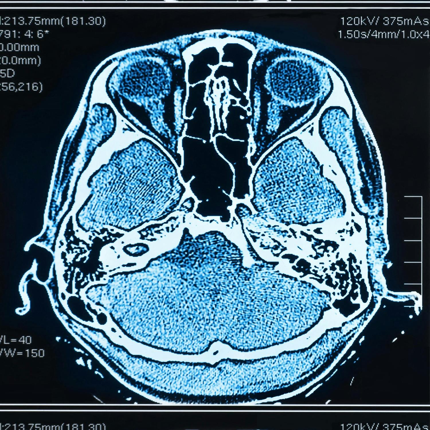 Detecting cancer using AI shows promise. Will it become the norm ?