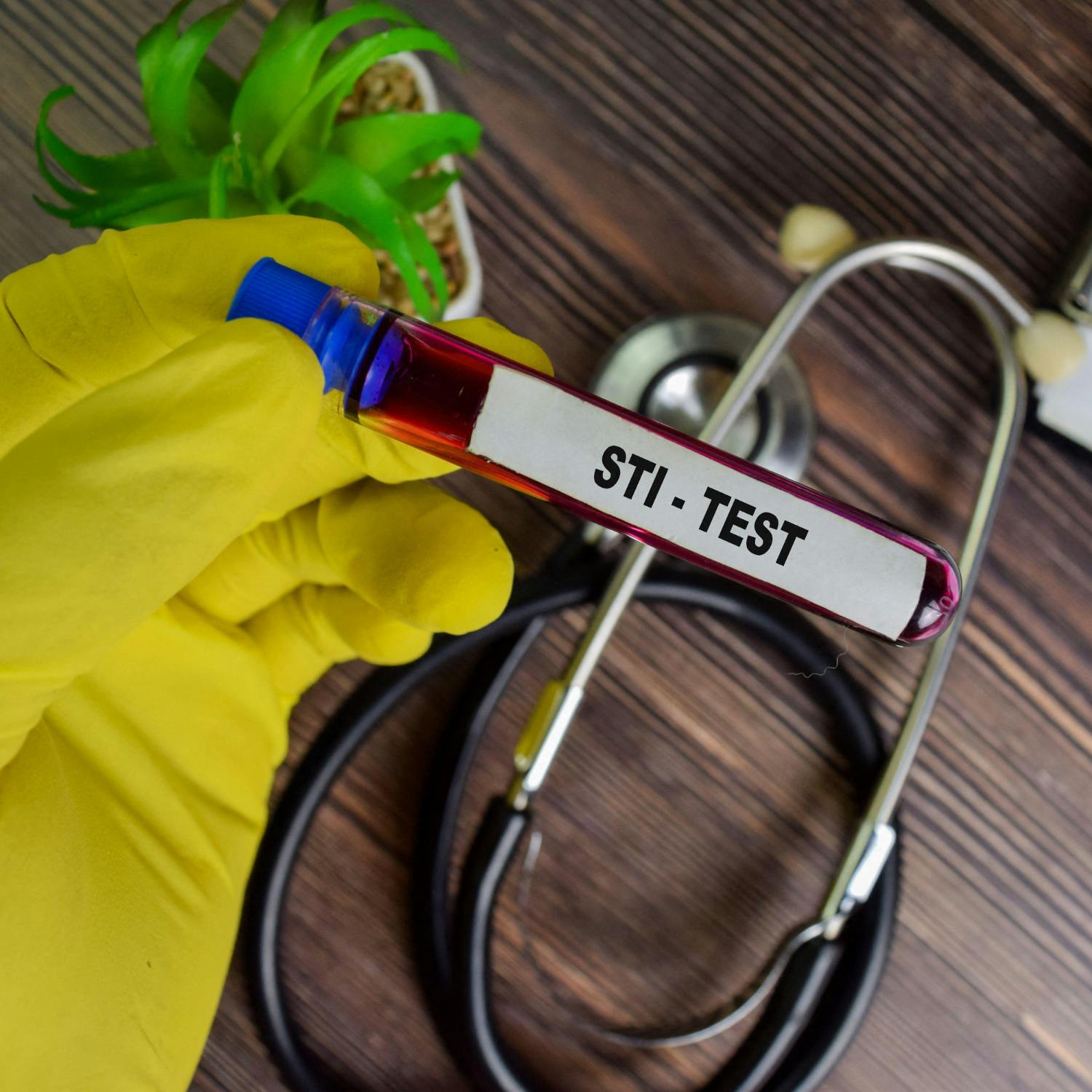 What is the cause in a post‑COVID rise in STIs? episode artwork
