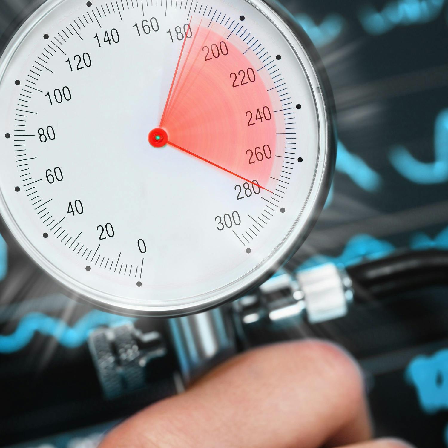 The rates of high blood pressure among children and teens