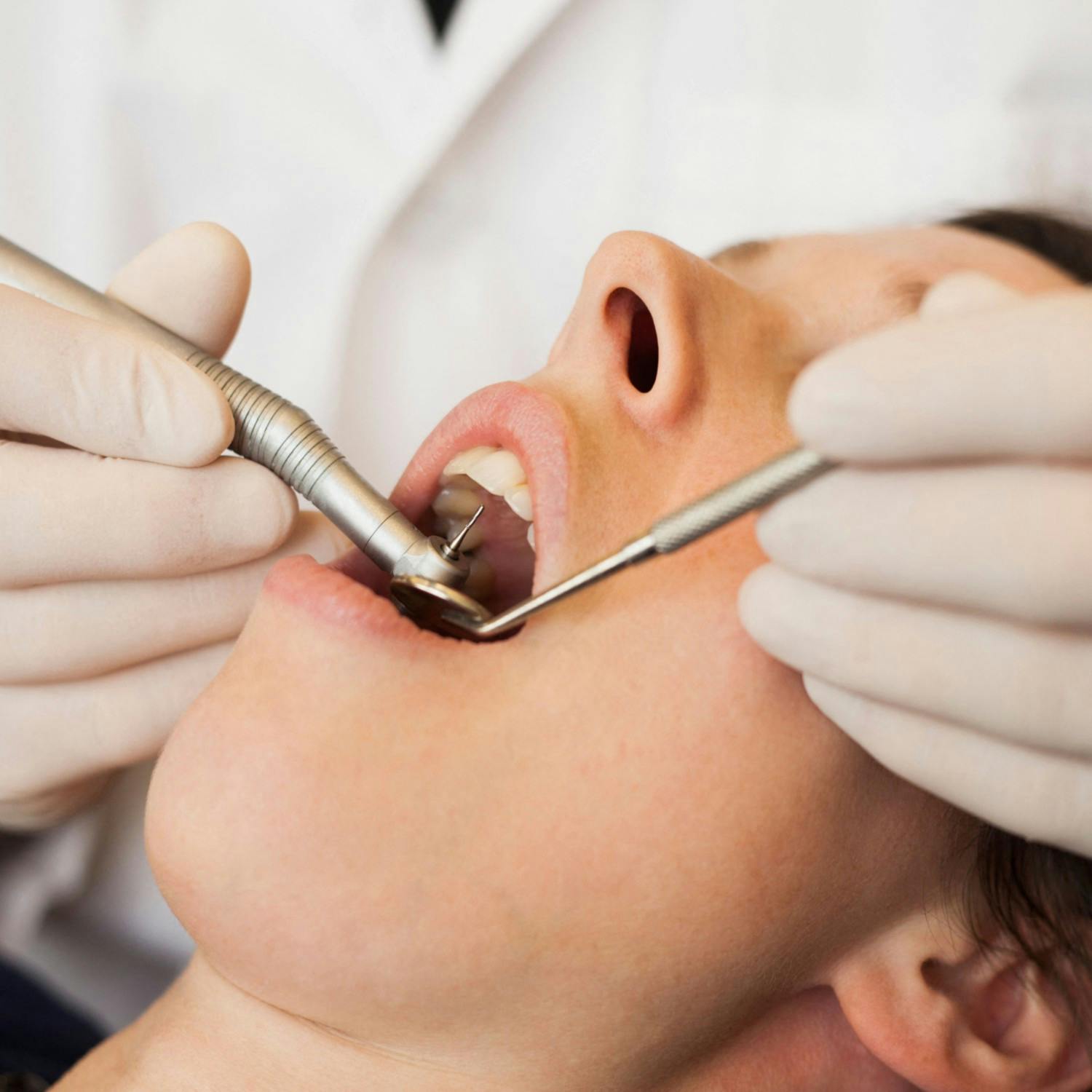 Dental scheme for medical card holders 'in a state of crisis'