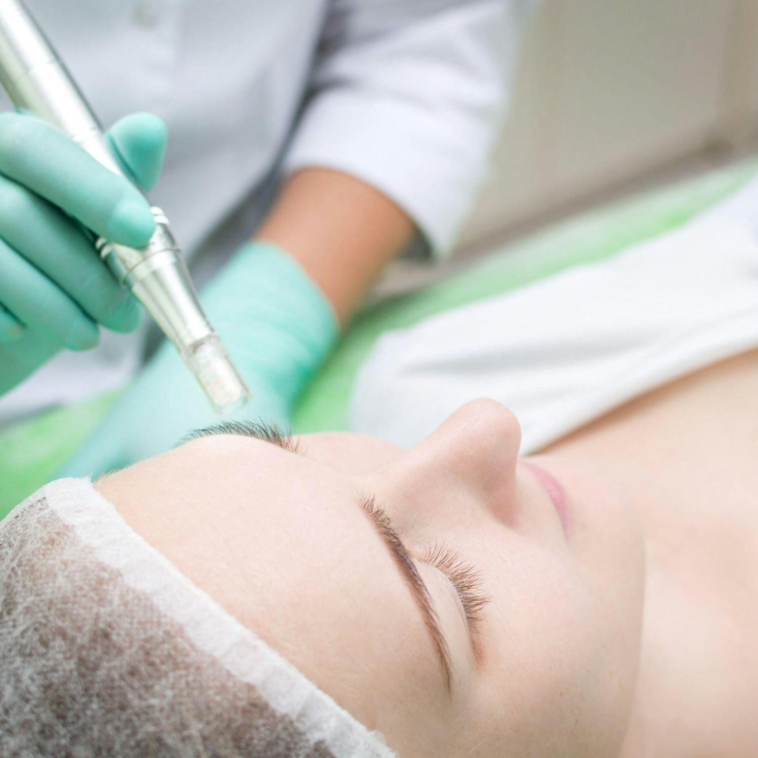 Ask The Expert: On  microneedling
