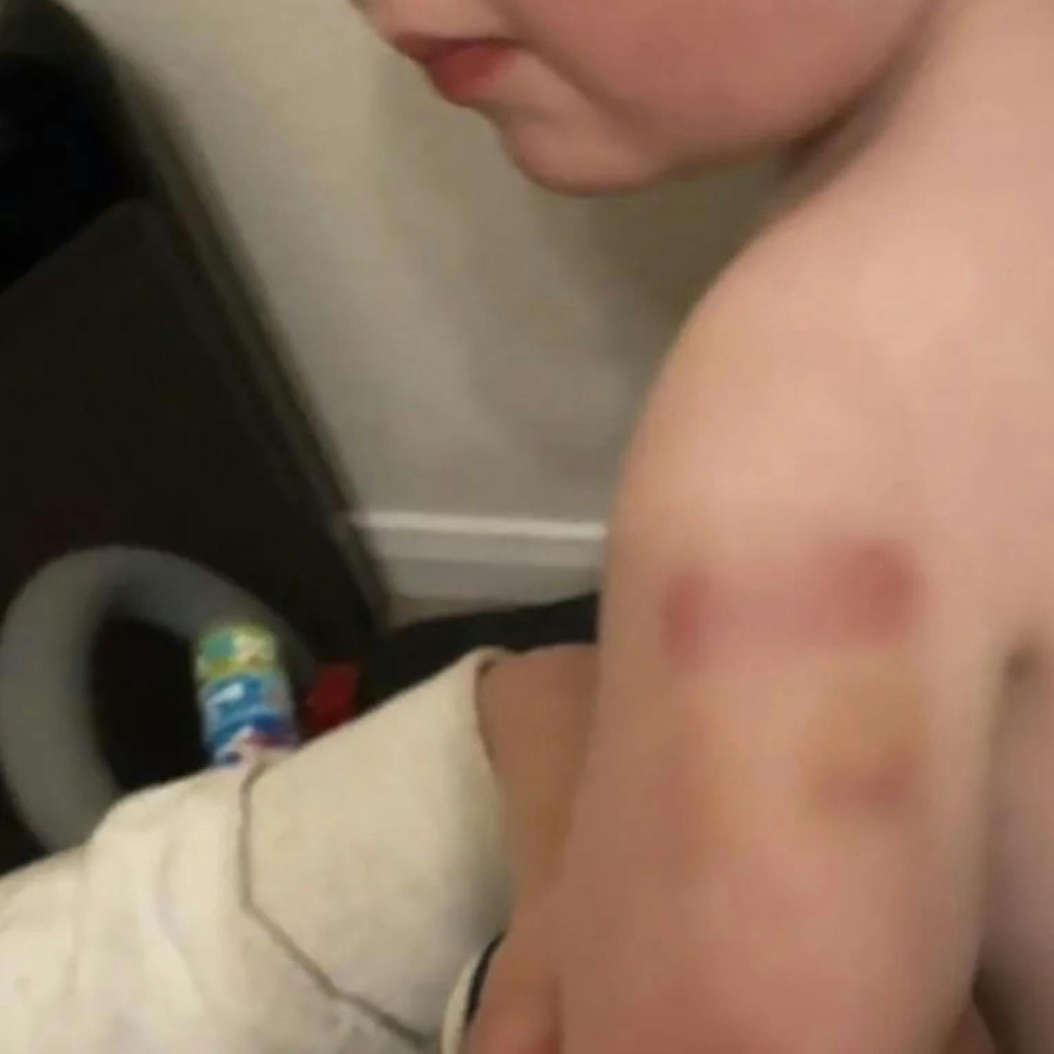 Biting Incident In Dublin Creche Causes Uproar With Callers