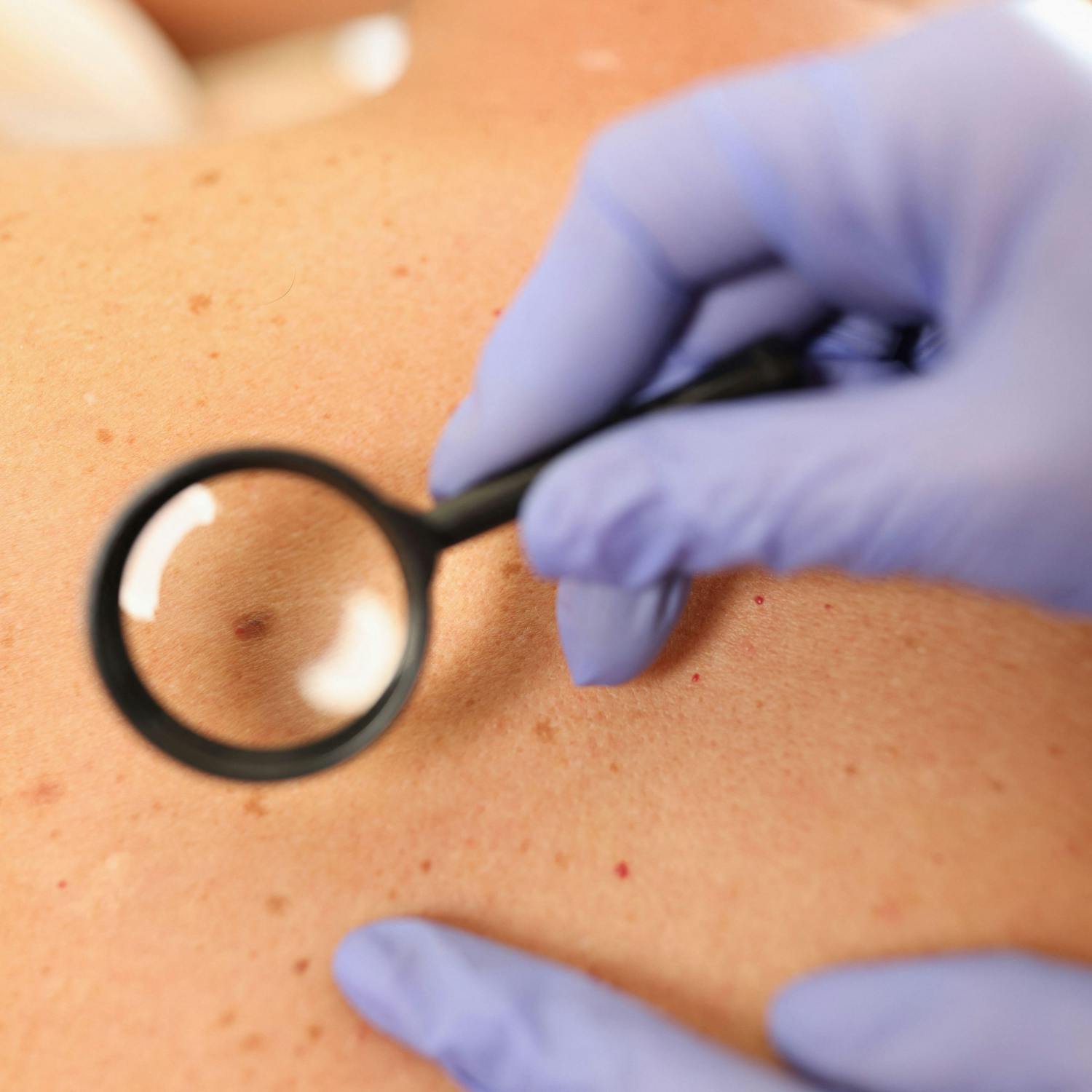 Ask The Expert: Dermatologist, Professor Caitriona Ryan