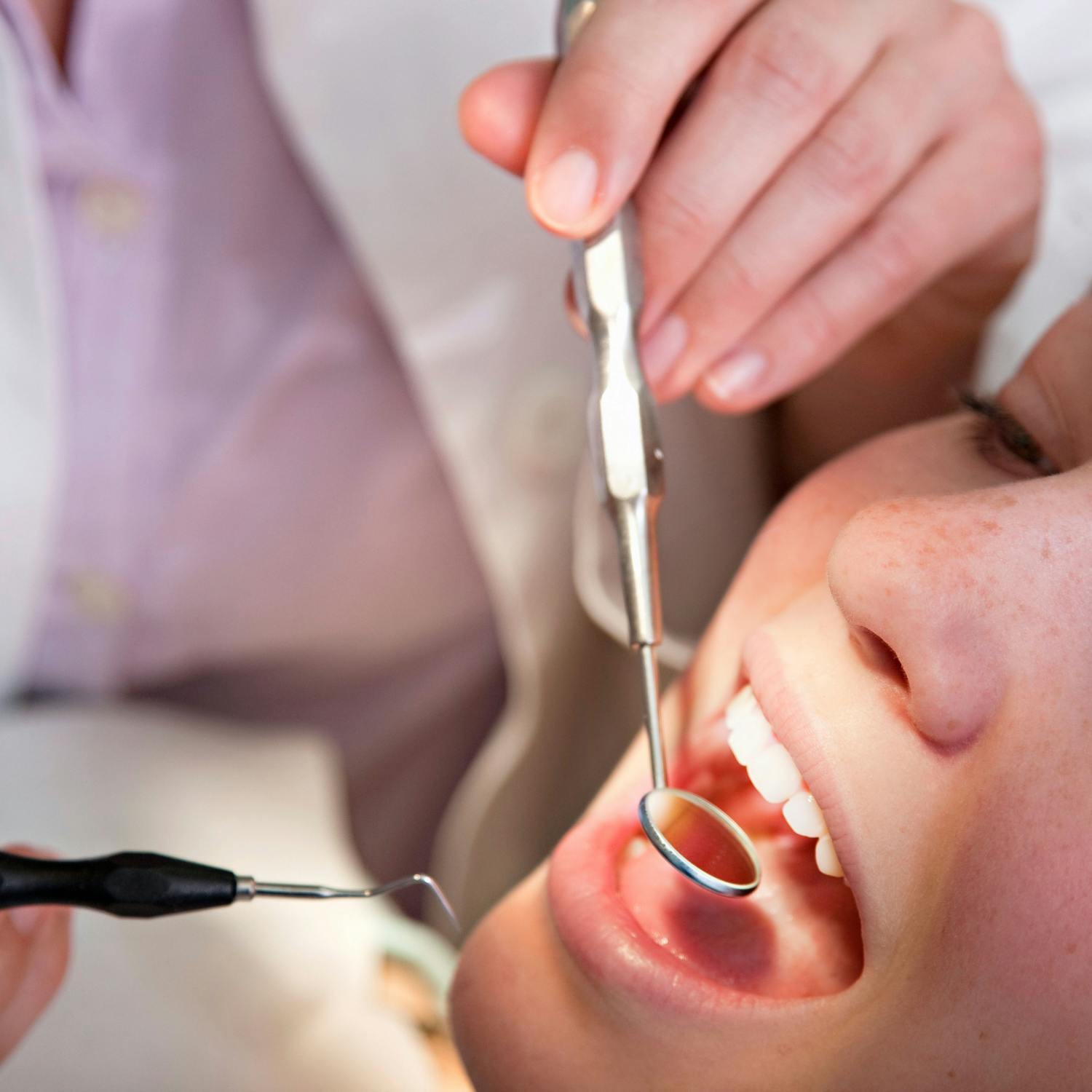 Ask The Expert: The fear of dentists!