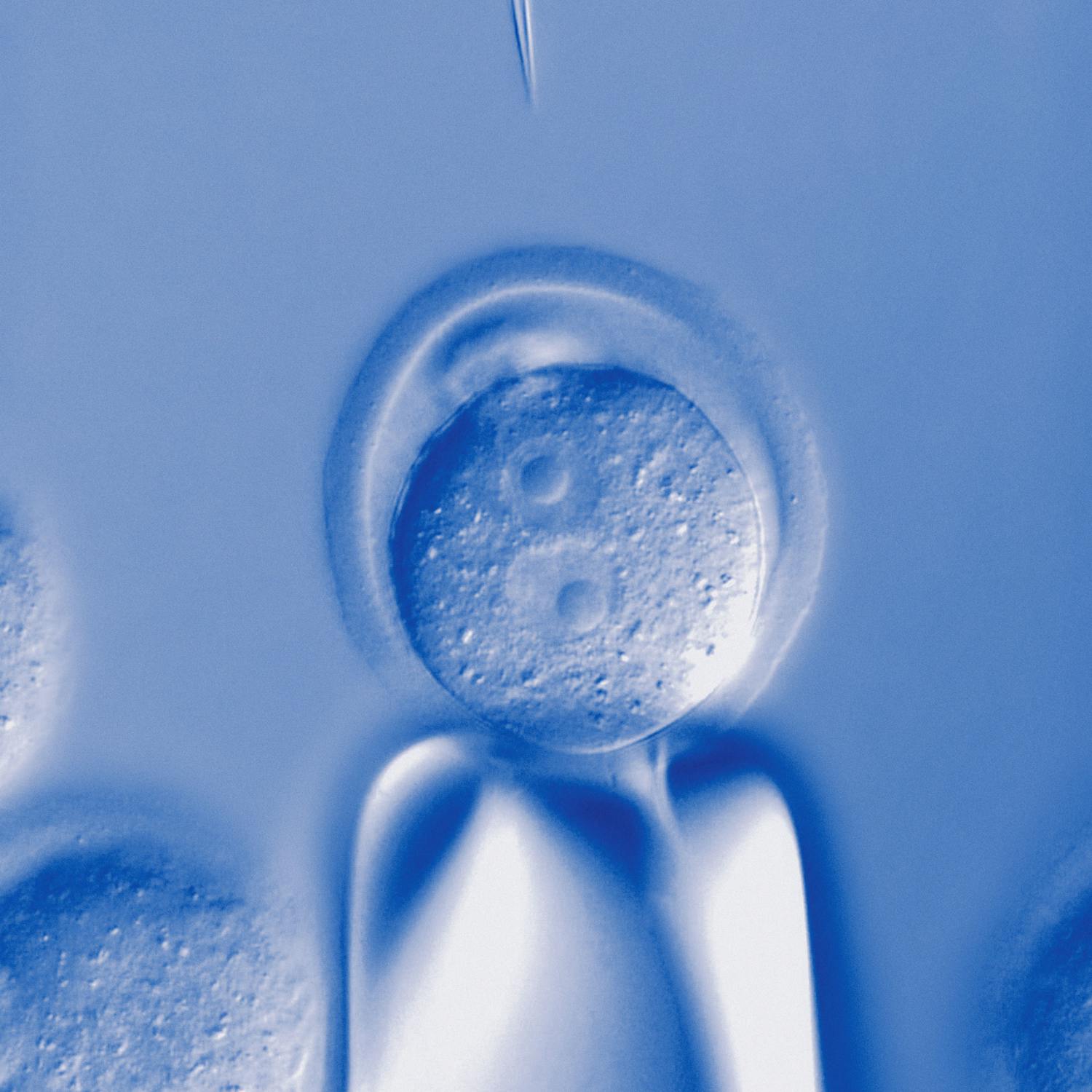 State will not fund egg-freezing for non-medical reason episode artwork