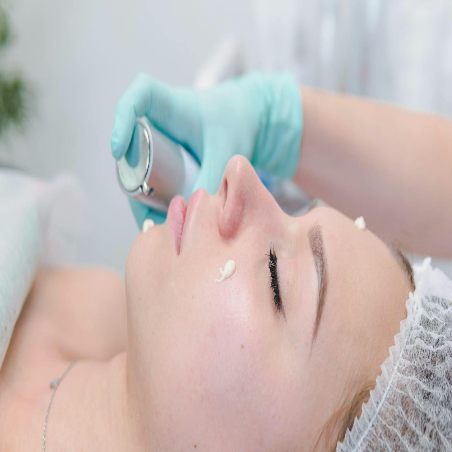 Dermatology - Pre-wedding-prep for brides to be